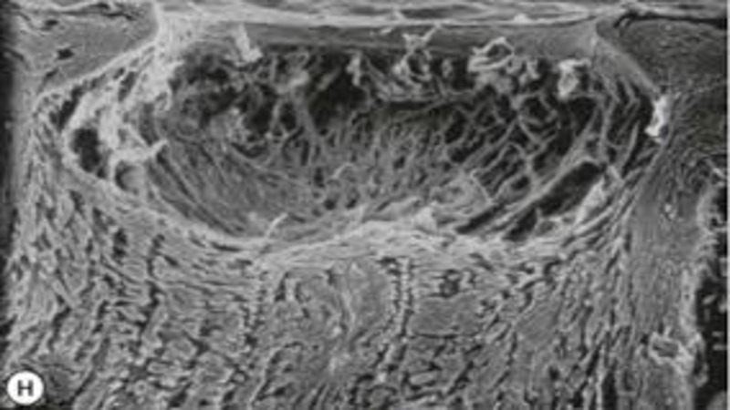 Microscopic view of a biological structure with intricate patterns, likely captured using an electron microscope.